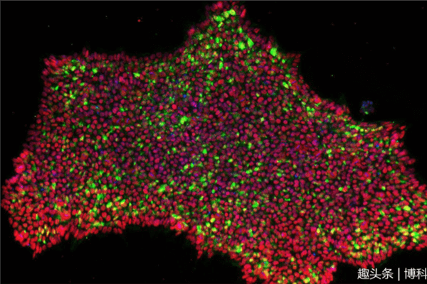 干细胞最新消息