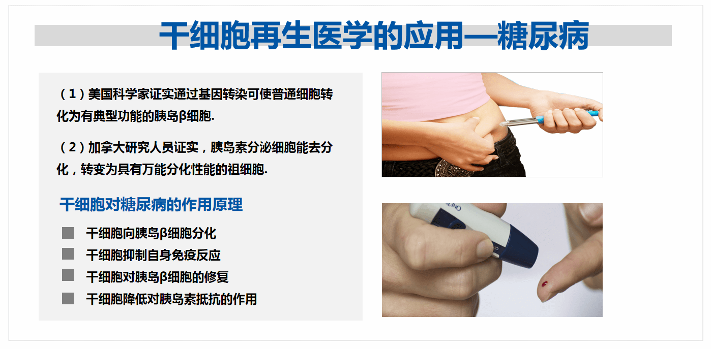 干细胞疗法治疗糖尿病