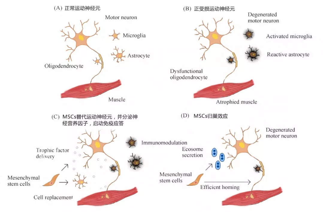 干细胞疗法调理ALS作用机制