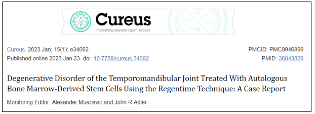 Cureus期刊最新报道：干细胞治疗1例下颌关节退行性疾病，随访显示完全康复